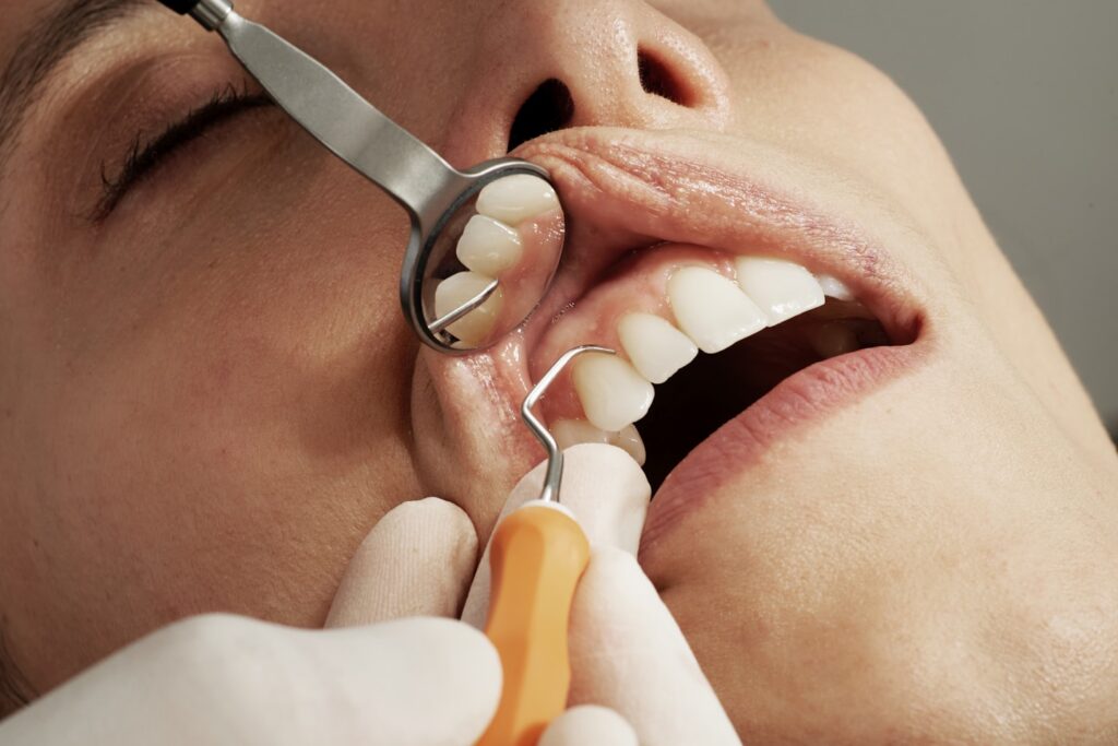 dental exam with mirror and tool